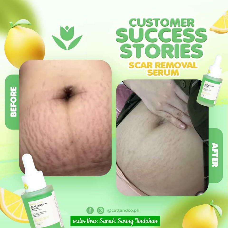 Catt & Co. Scar Removal Serum
