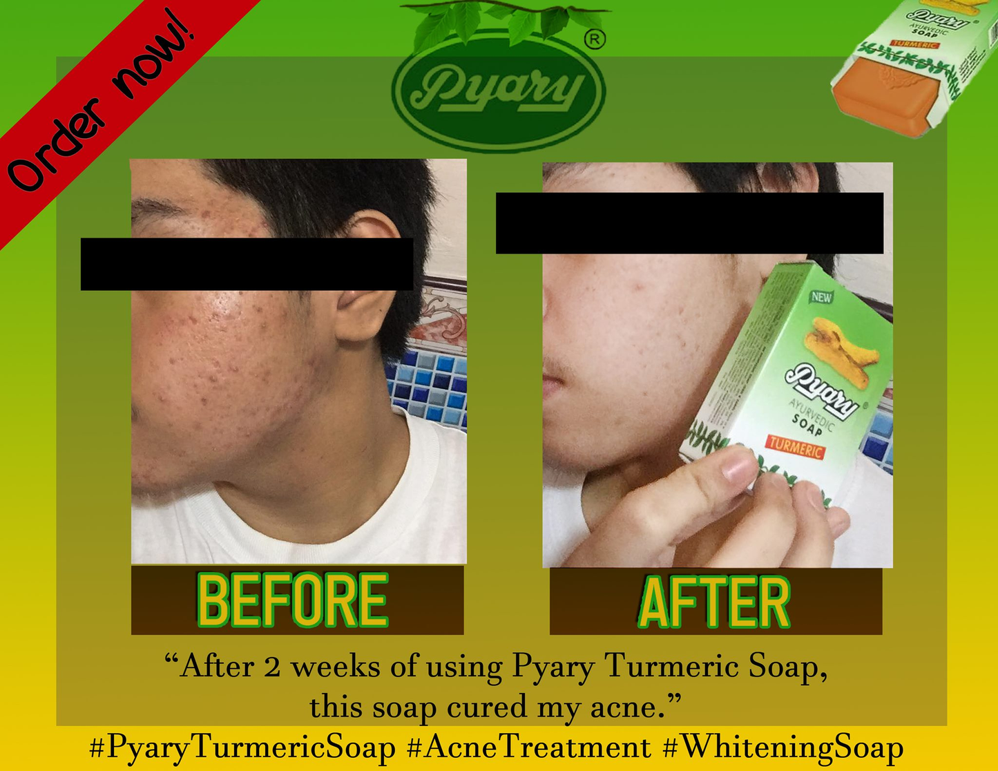 Pyary Ayurvedic Turmeric Soap (75G)