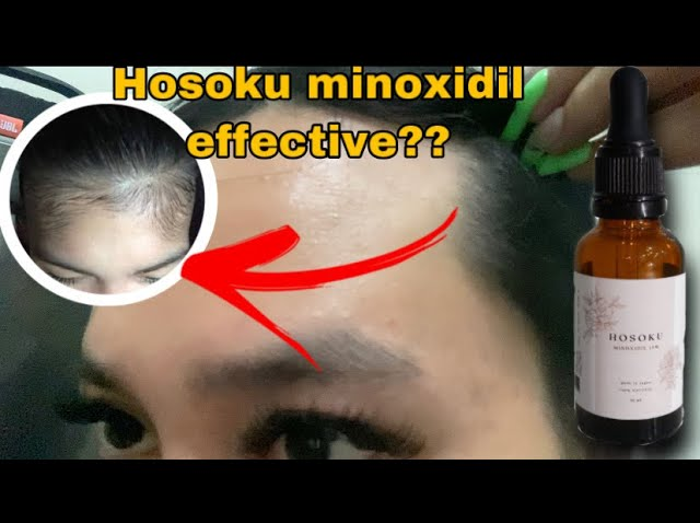 HOSOKU MINOXIDIL 15% ORIGINAL Hair Growth With Collagen And Castor Oil Hosoku Hair Growth Serum