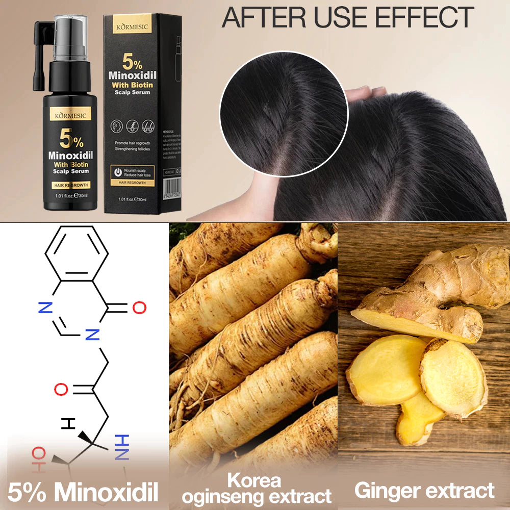 5% Minoxidil Biotin Hair Grower Spray 30ml - DHT Blocker For Hair Loss Treatment