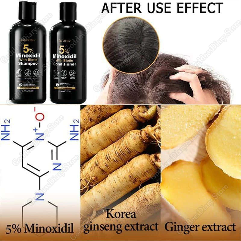 Minoxidil 5% Hair Grower Shampoo with Biotin for Hair Loss Treatment Regrowth Hair