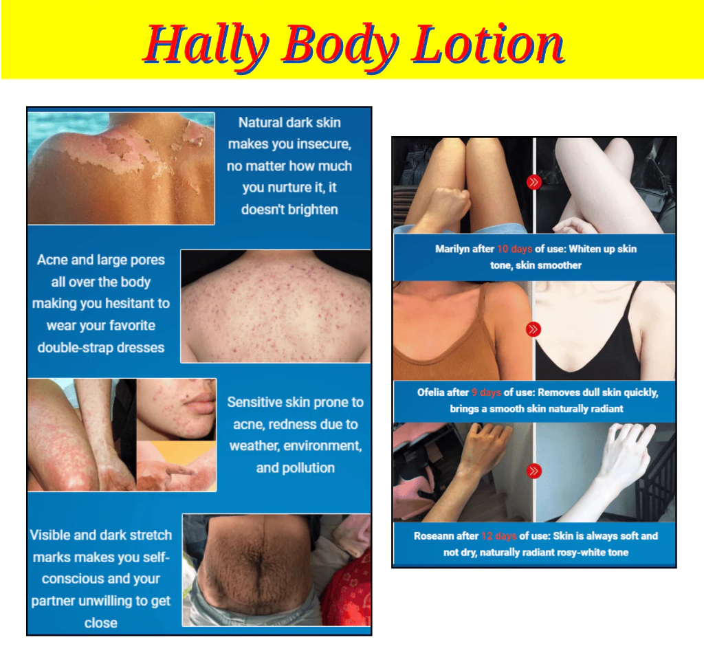 Original Hally Body Lotion l Nourish your Skin l For all Skin Type l Natural Ingredients l 1 Bottle 250 ml