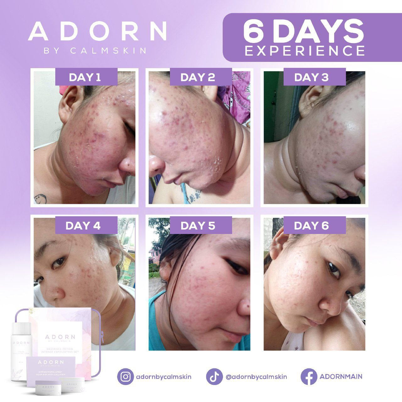 Adorn Rejuv Set Radiance Potion Intense Exfoliating