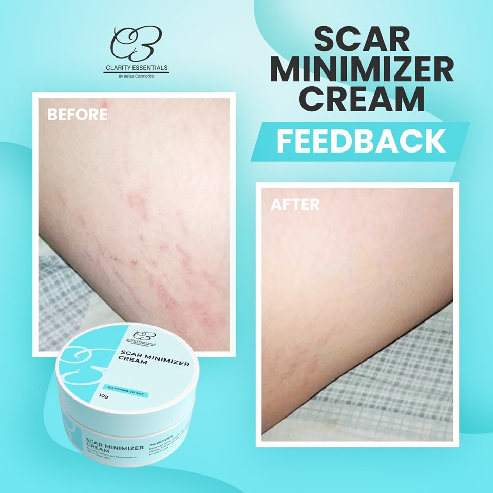 CLARITY ESSENTIALS SCAR MINIMIZER 10g