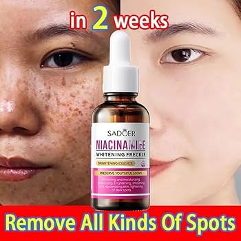Sadoer Niacinamide Serum - 30ml | Hydrating & Smoothing Formula for a Youthful Glow