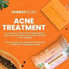 HONEST GLOW KOJIC SOAP 100G