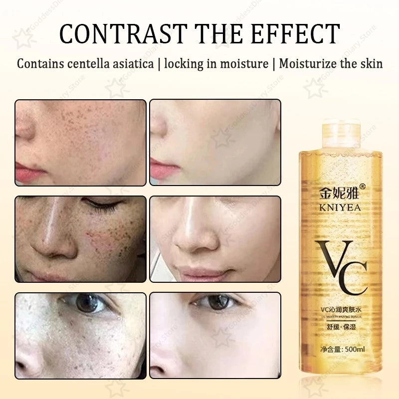 Buy 1 Take 2! Beauty Set Vitamin C Toner Intensive Whitening Remove Acne Pimple Marks Soft MinimizePores