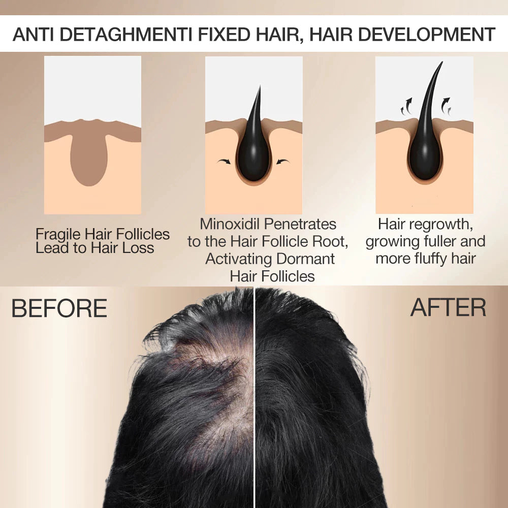5% Minoxidil Biotin Hair Grower Spray 30ml - DHT Blocker For Hair Loss Treatment