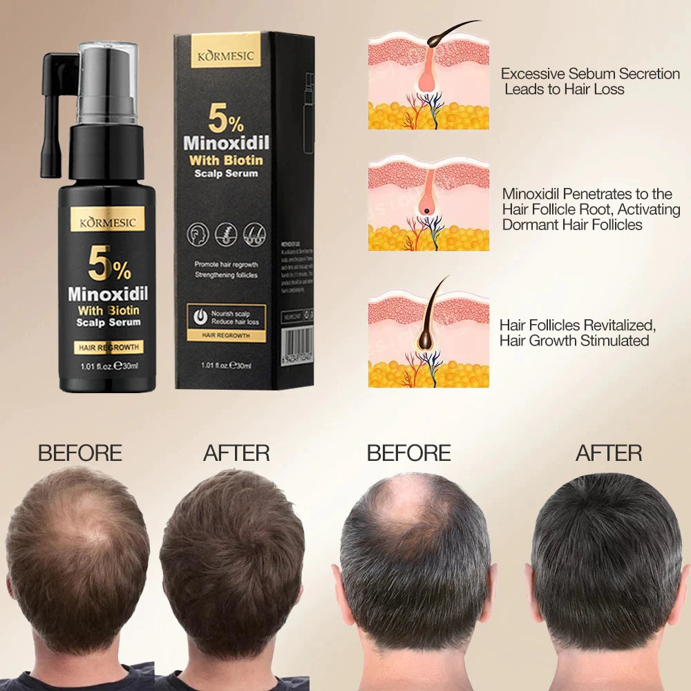 5% Minoxidil Biotin Hair Grower Spray 30ml - DHT Blocker For Hair Loss Treatment