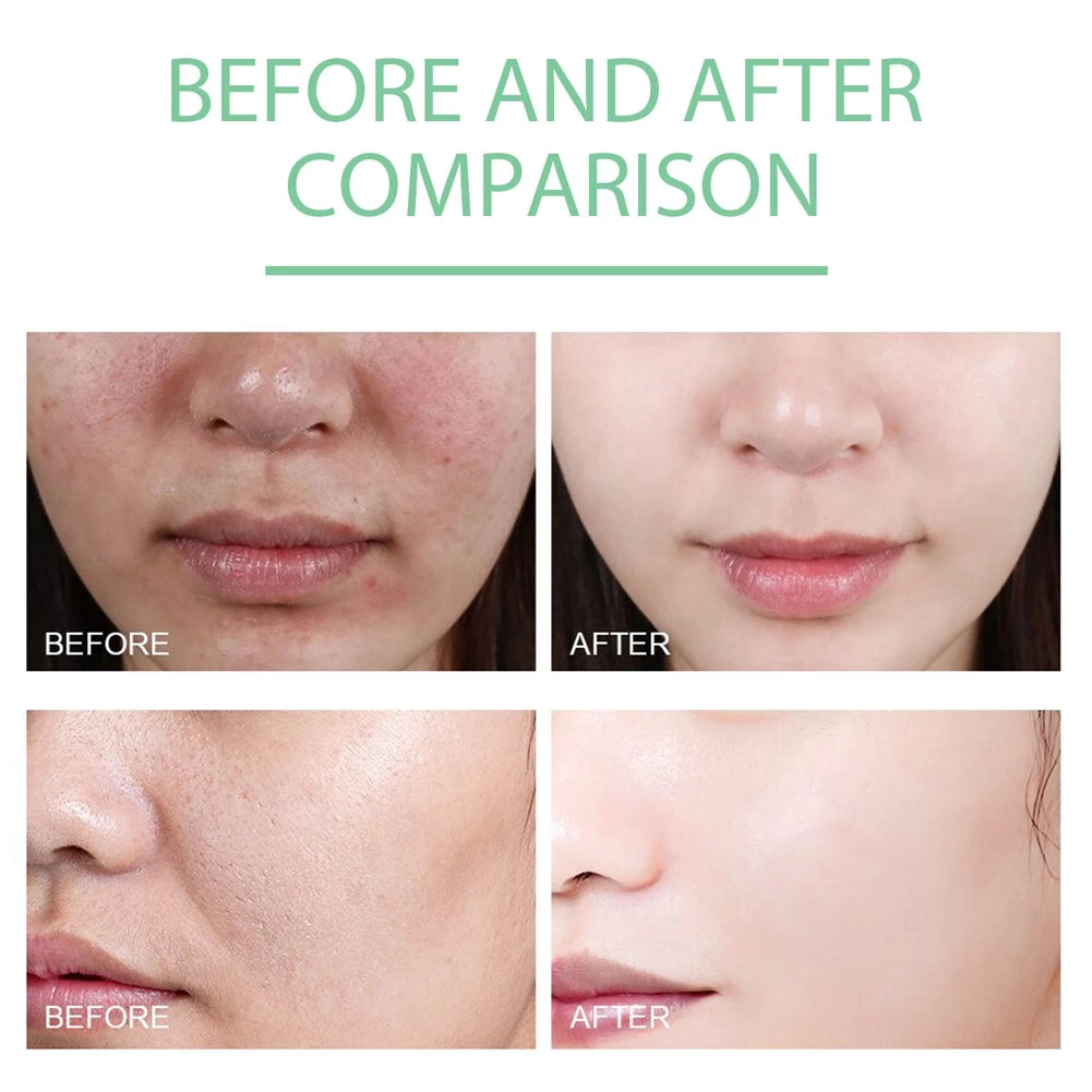 She Eureka Exfoliating Gel 100g Gently Cleans Closed Black Mouth Shrinks Pore Exfoliate