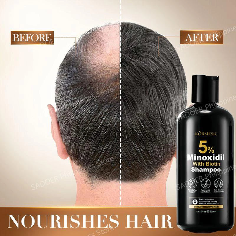 Minoxidil 5% Hair Grower Shampoo with Biotin for Hair Loss Treatment Regrowth Hair