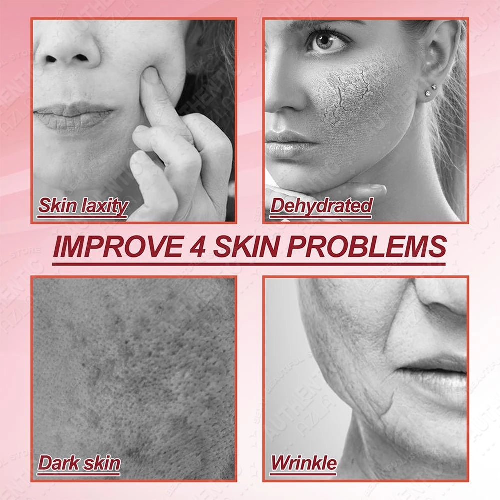 Retinol Cream Dragon Blood Cream Whitening Moisturizing Melasma Remover Ance Freckles Remover 50g