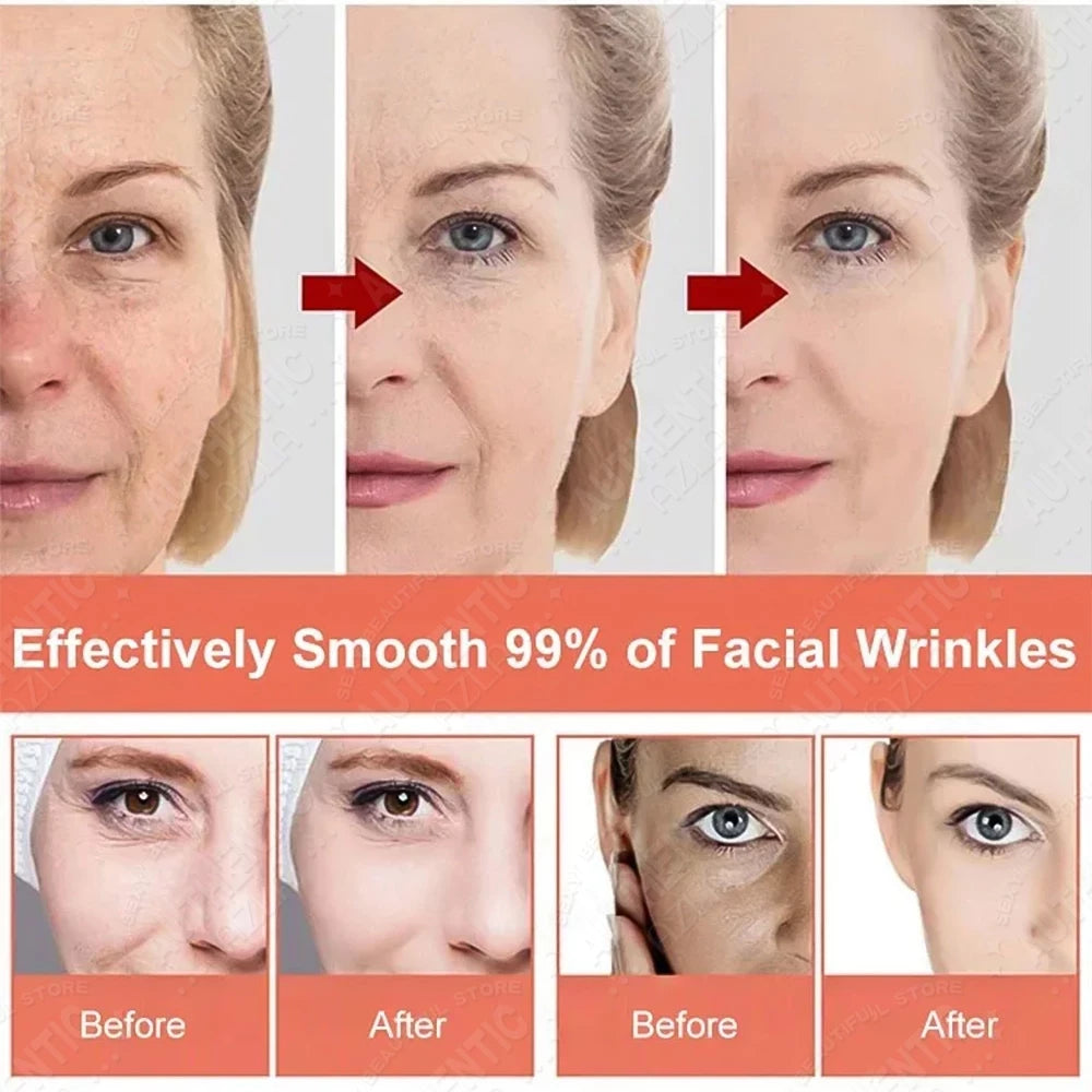 Retinol Cream Dragon Blood Cream Whitening Moisturizing Melasma Remover Ance Freckles Remover 50g