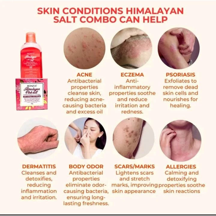 BONITA Himalayan Pink Salt Soap 80g | Anti itch Acne Antibacterial Moisturizing Scar Psoriasis